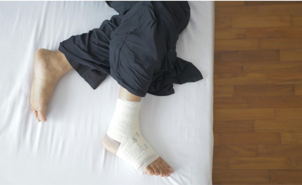 A person with a malunion fracture is resting on bed